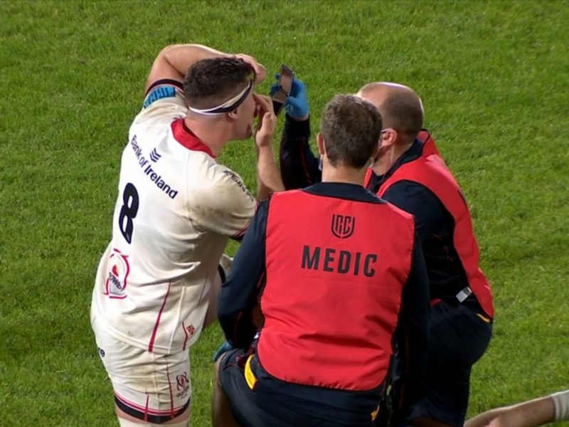 rugby-CA contact lenses for rugby